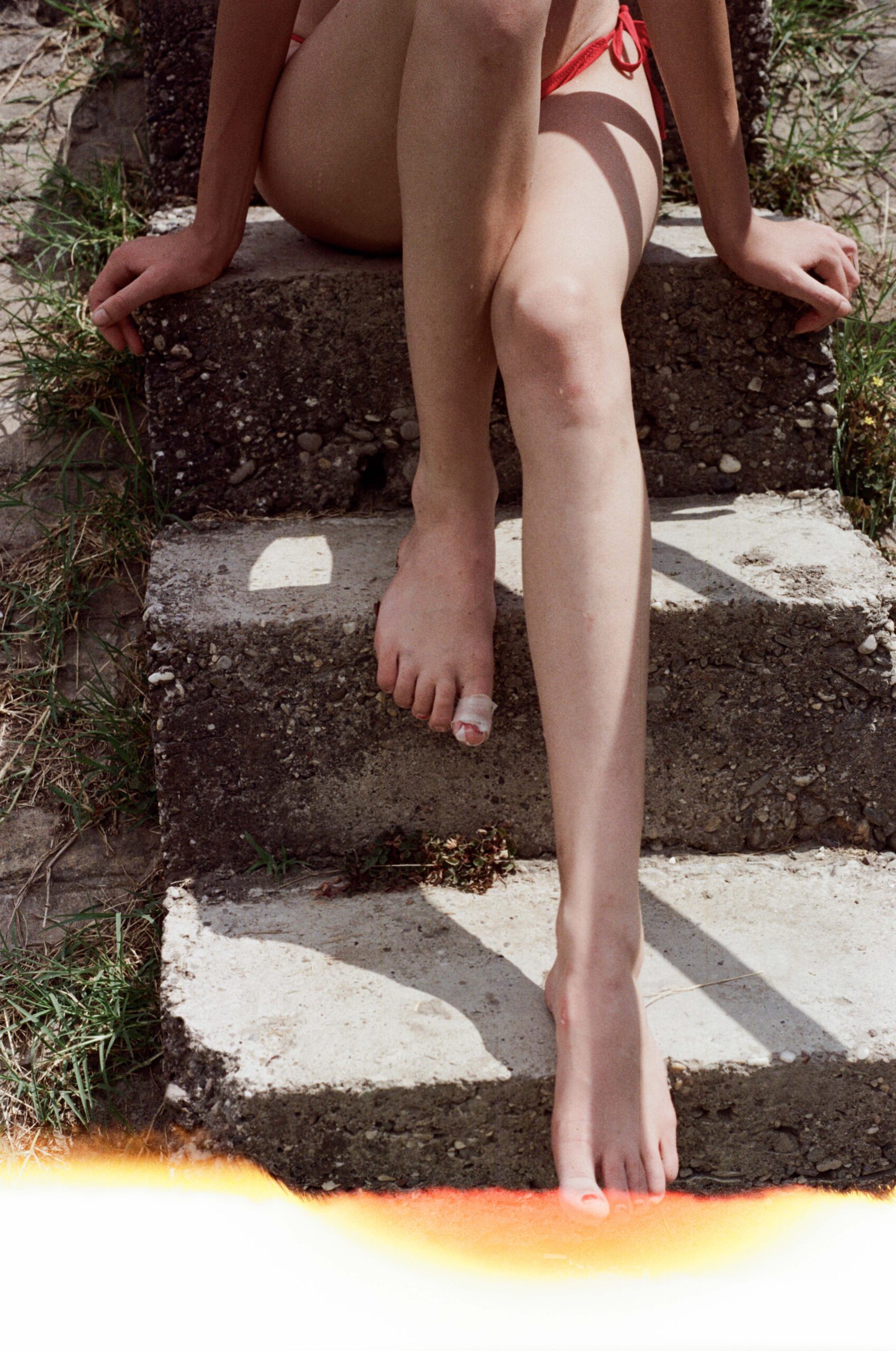 Wound